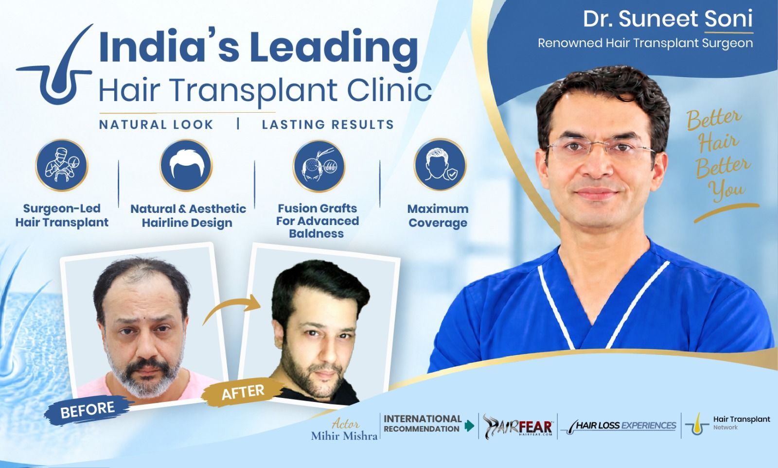 hair transplant
